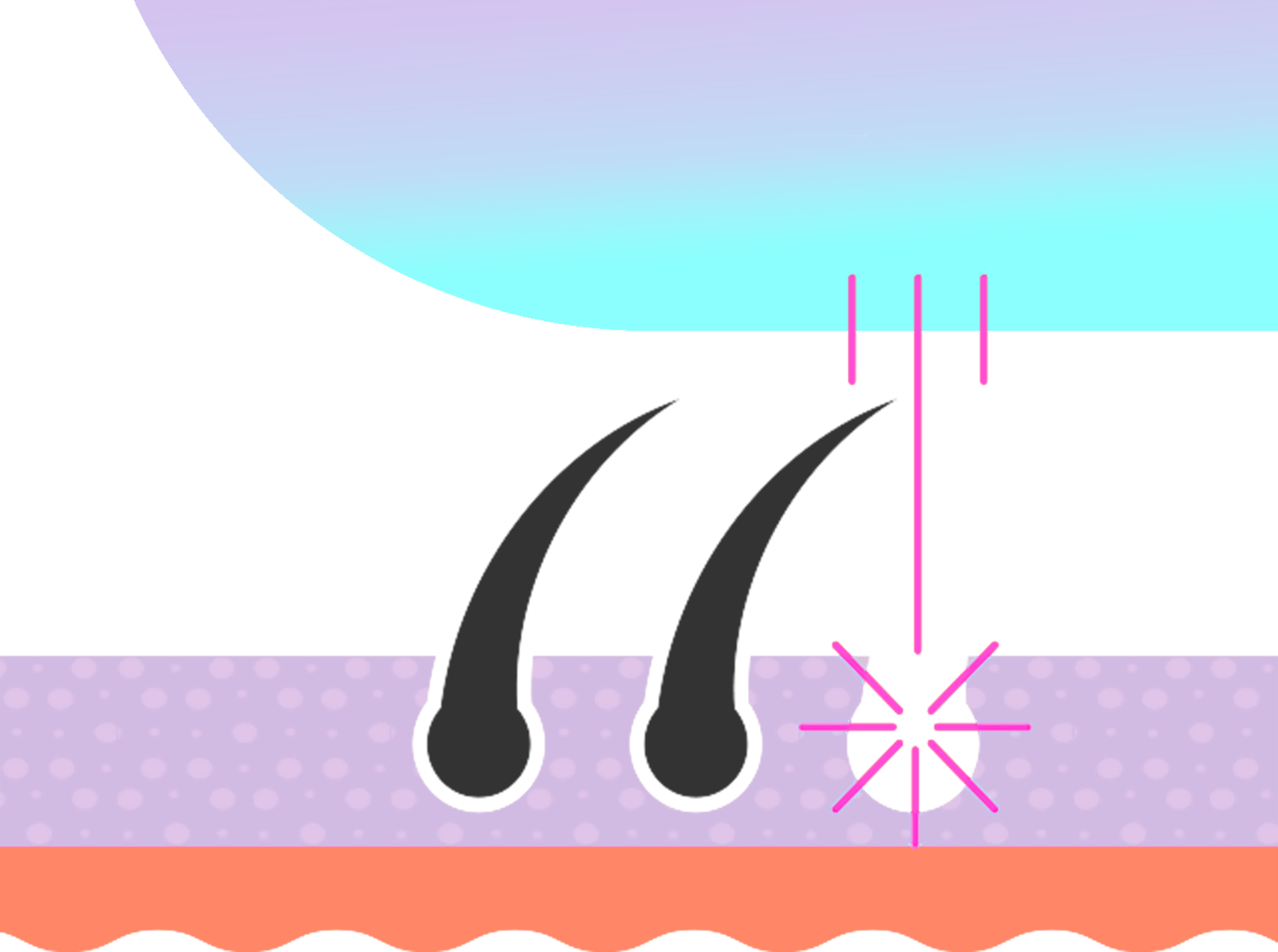 Illustration of a hair follicle